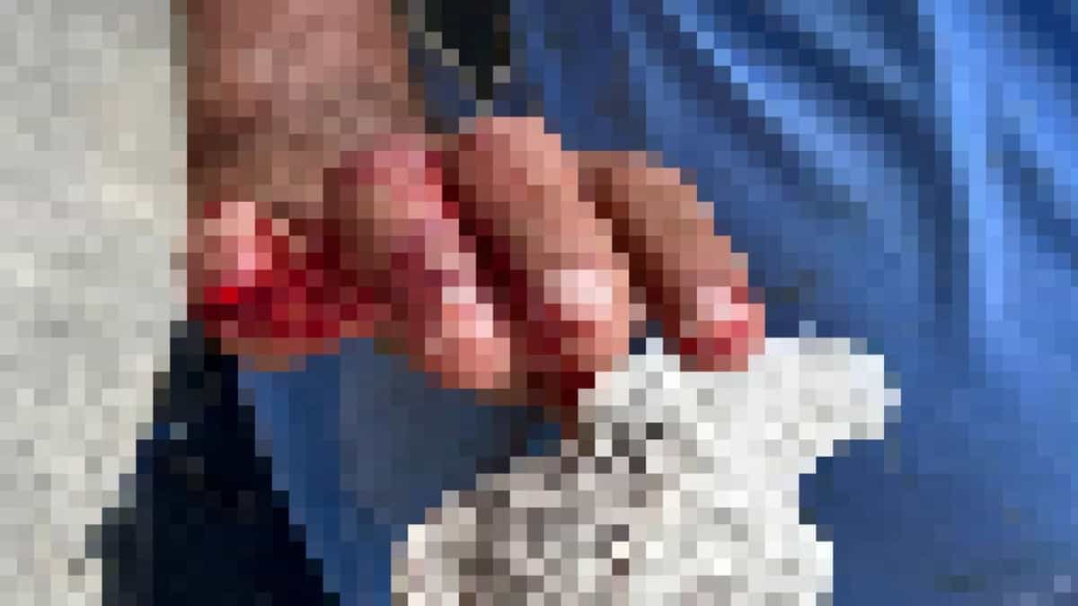 Turista arranca parte del dedo a empleado municipal afuera de un Oxxo en Playa del Carmen