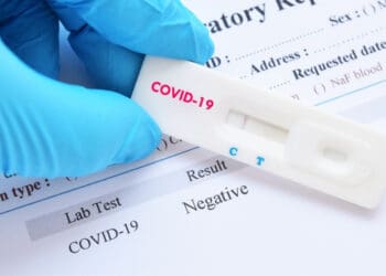 Gobierno municipal atiende Covid-19 con más pruebas gratuitas