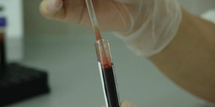 Concientizan a la población en el marco del Día Mundial de la Lucha contra el Sida