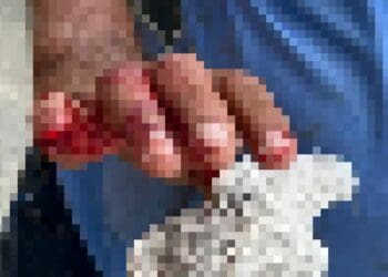 Turista arranca parte del dedo a empleado municipal afuera de un Oxxo en Playa del Carmen