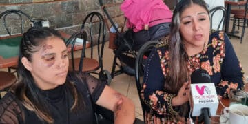 Piden ayuda para localizar a conductor que atropelló a una joven y se dio a la fuga en el centro de Playa del Carmen