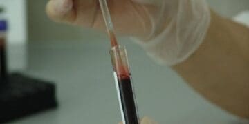 Playa del Carmen, primer lugar en contagios de VIH en América Latina; jóvenes deben cuidarse