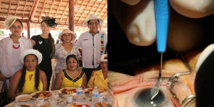 Desayuno del Sombrero a beneficio de cirugías de cataratas y pterigión